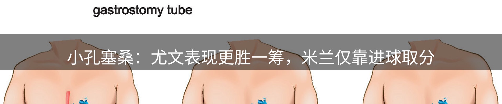 热点摘要